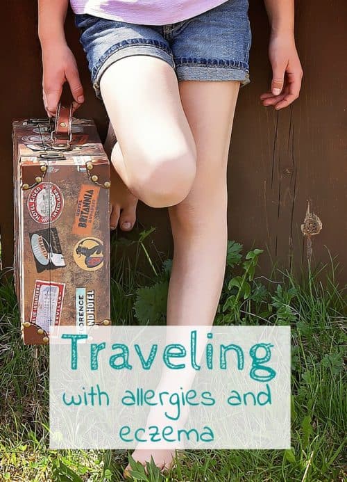 Dealing with allergic reactions or eczema isn't fun and can interrupt your travel. Incorporating these tips and products into travel and vacation plans. DomesticDeadline.com
